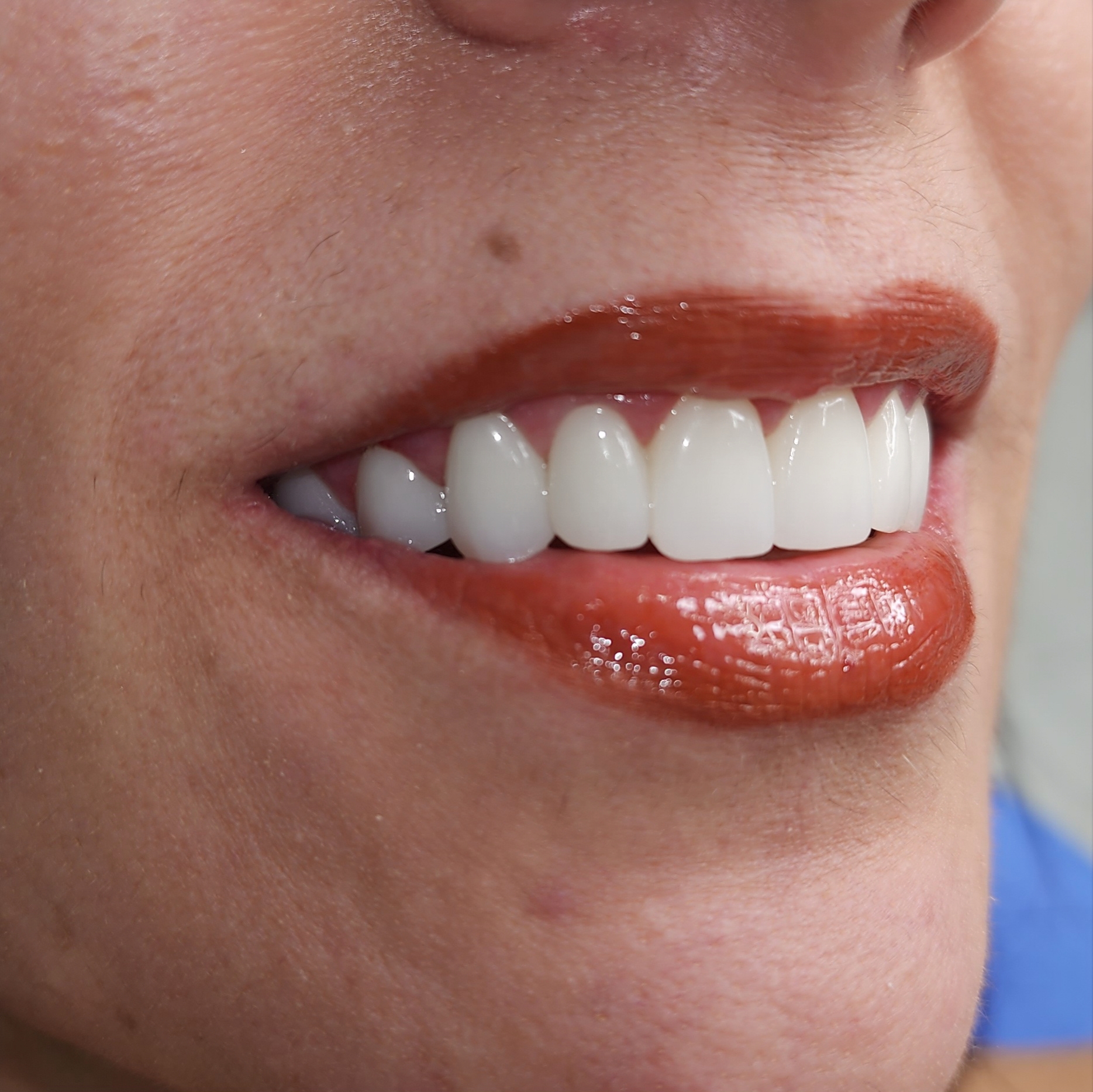 BeautyPlus_20231117203450771_save