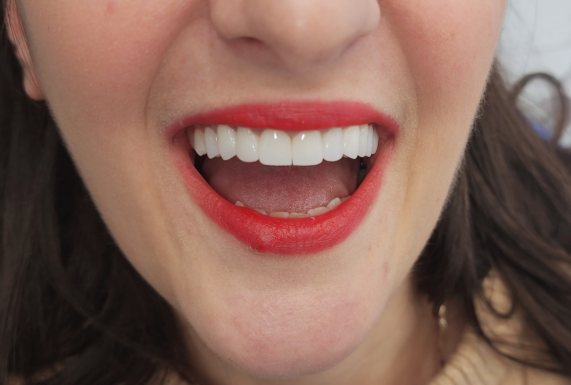 BeautyPlus_20231222143341033_save