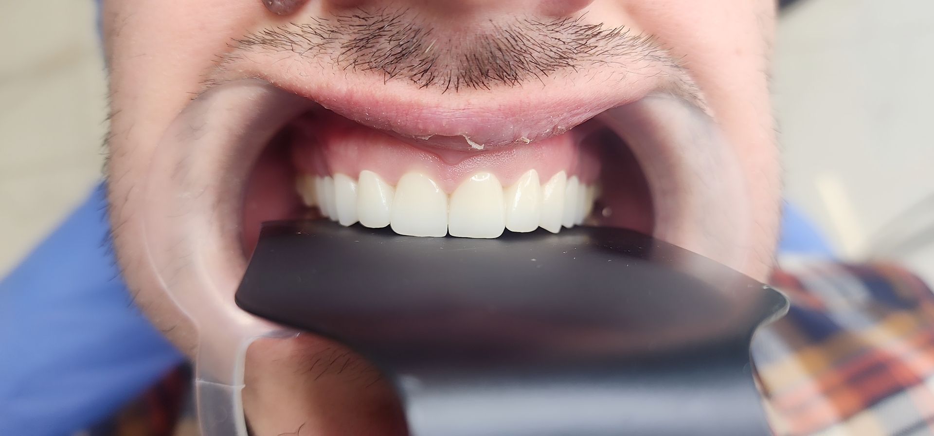 BeautyPlus_20231223123428885_save