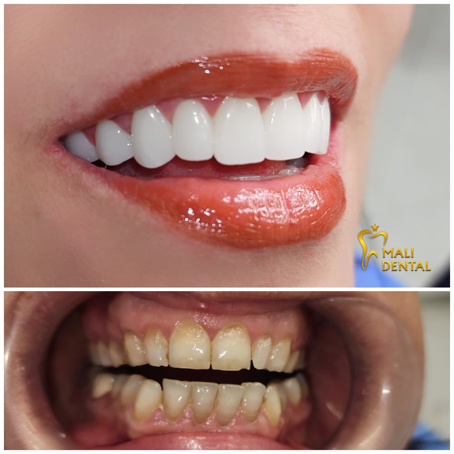 IMG_20231116_225951_080