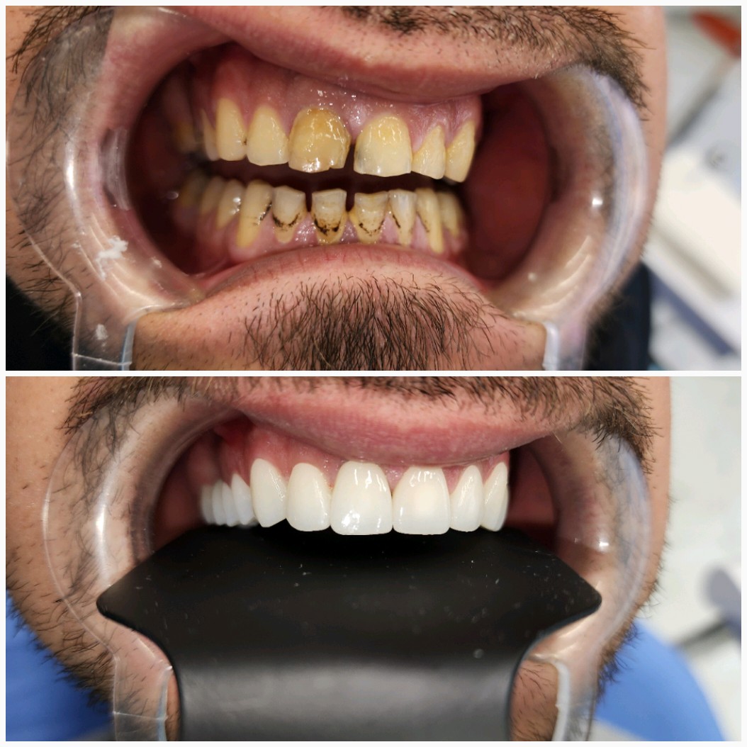 PhotoGrid_1_20231207104022