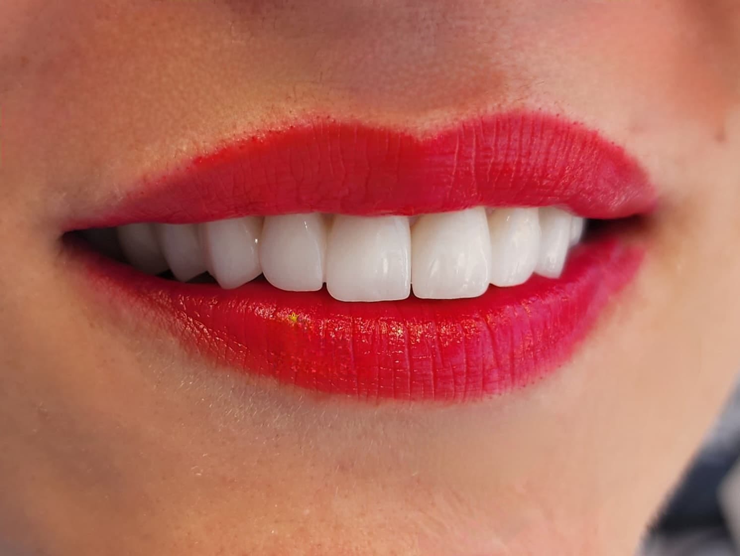 WhatsApp Image 2025-03-03 at 5.34.15 AM