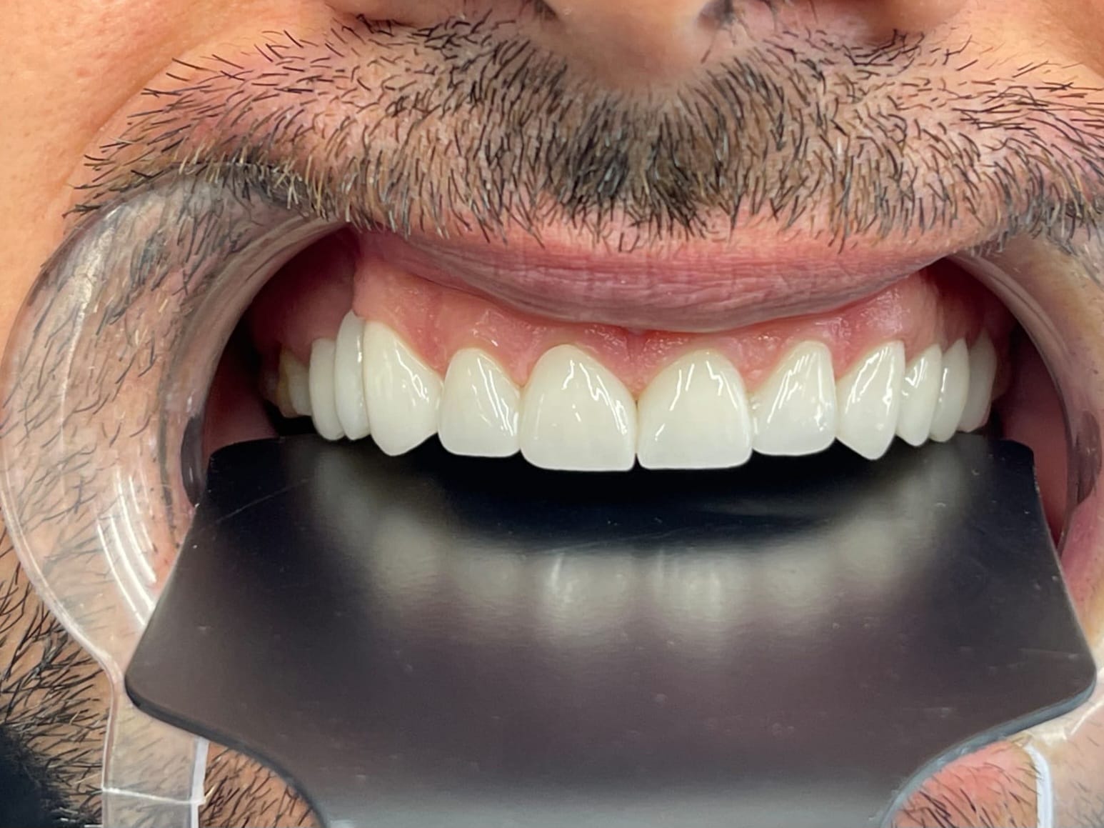 WhatsApp Image 2025-03-05 at 2.30.04 AM (2)